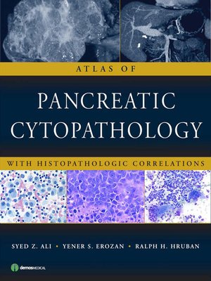 cover image of Atlas of Pancreatic Cytopathology